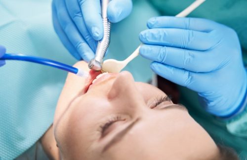 dentist-hands-performing-dental-procedure-with-den-2022-03-31-17-41-09-utc